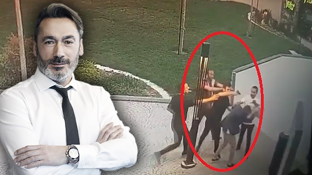 Sağlıkçılara yine şiddet! Tıp literatürüne giren profesöre silah kabzasıyla darp kamerada