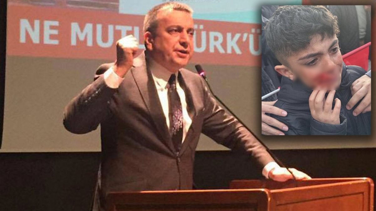 Eski Ülkü Ocakları Başkanı Erzurum’da yaralanan çocuğu paylaştı: Sana kan revan içinde bir Türkiye bırakmayacağız