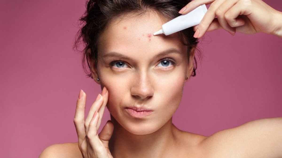 Yüzdeki Yağ Bezeleri Nasıl Geçer?