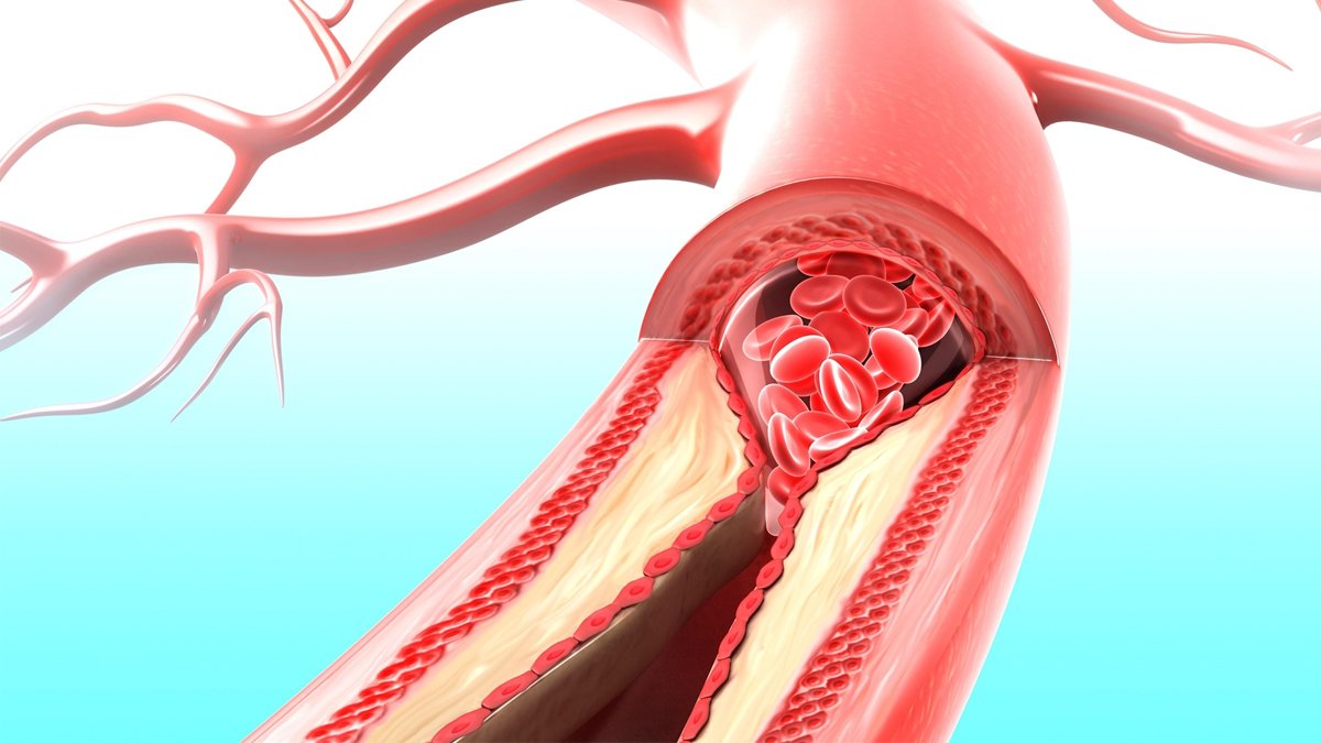En İyi Damar Açıcı Bitki Nedir?