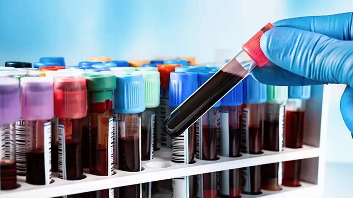 Kan Tahlilinde Sigara Çıkar mı?