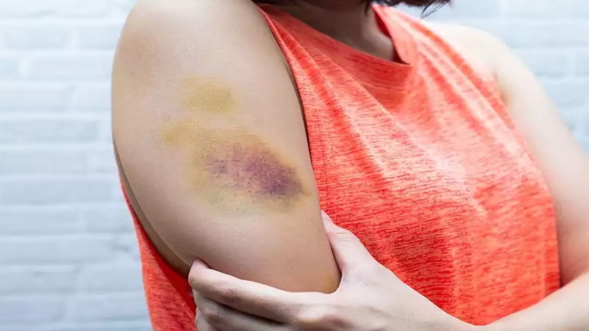 Morarmaya Ne İyi Gelir?