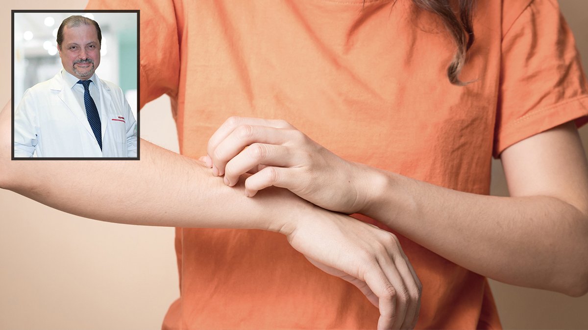 Prof. Korkut'tan 'salgın' uyarısı: Uyuz Türkiye'ye göçle geliyor