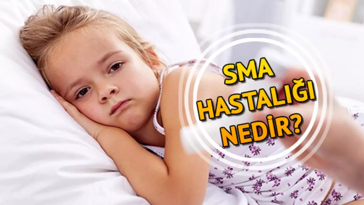 SMA Nedir?