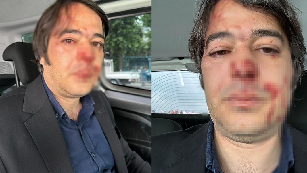 Kaçak yapı yıkımında İBB müdürüne darp: Kafe sahipleri tarafından saldırıya uğradı