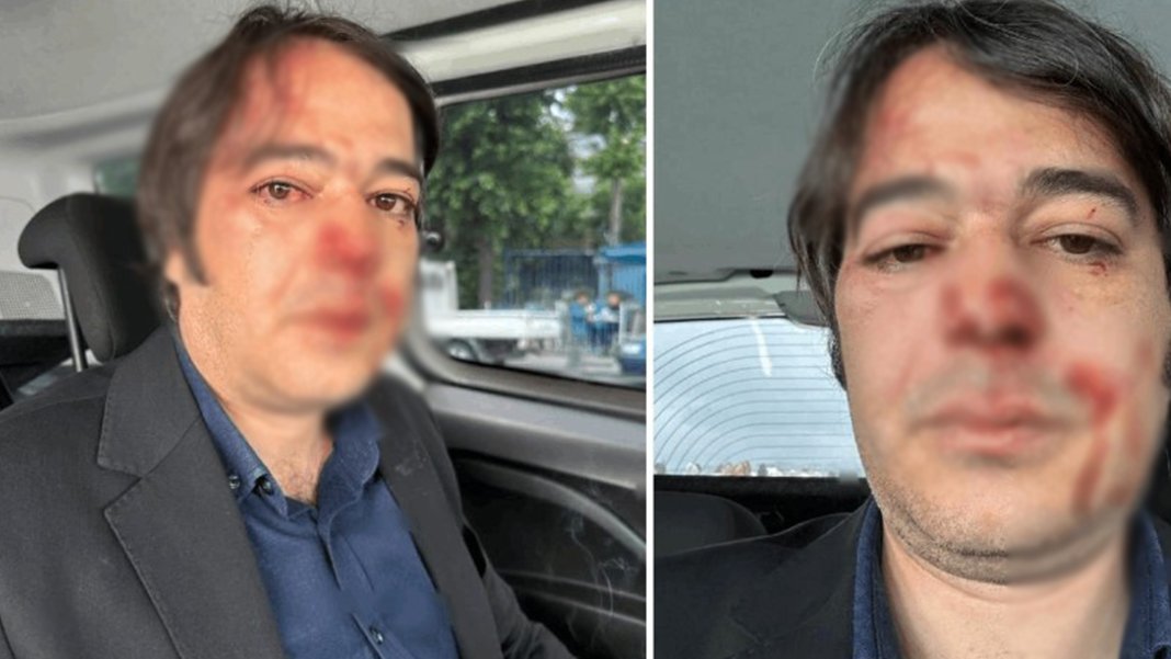 İBB yöneticisine saldıran şahıs hakkında karar: İki günde tahliye!