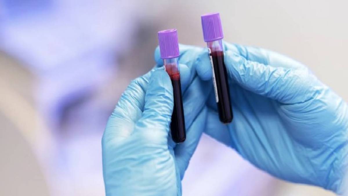 Uzmanlar açıkladı: Bu kan grubundaki kişiler yüksek IQ’ya sahip! En zeki kan grupları belli oldu!