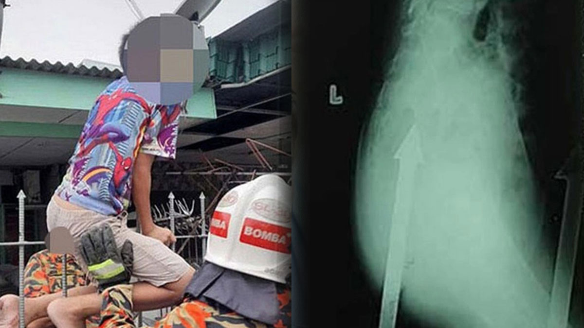 Korkunç çığlık sonrası bahçede korkunç manzarayla karşılaştılar! 15 metal direk, talihsiz çocuğun...