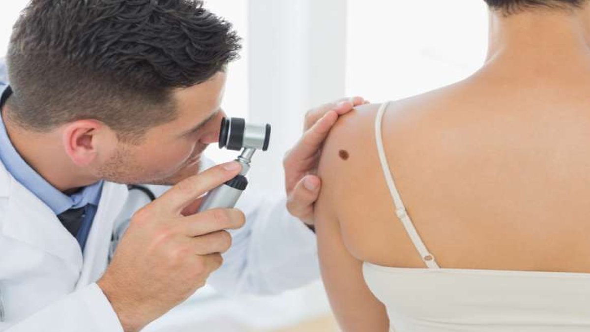 Kan Kanseri Son Evre Belirtileri