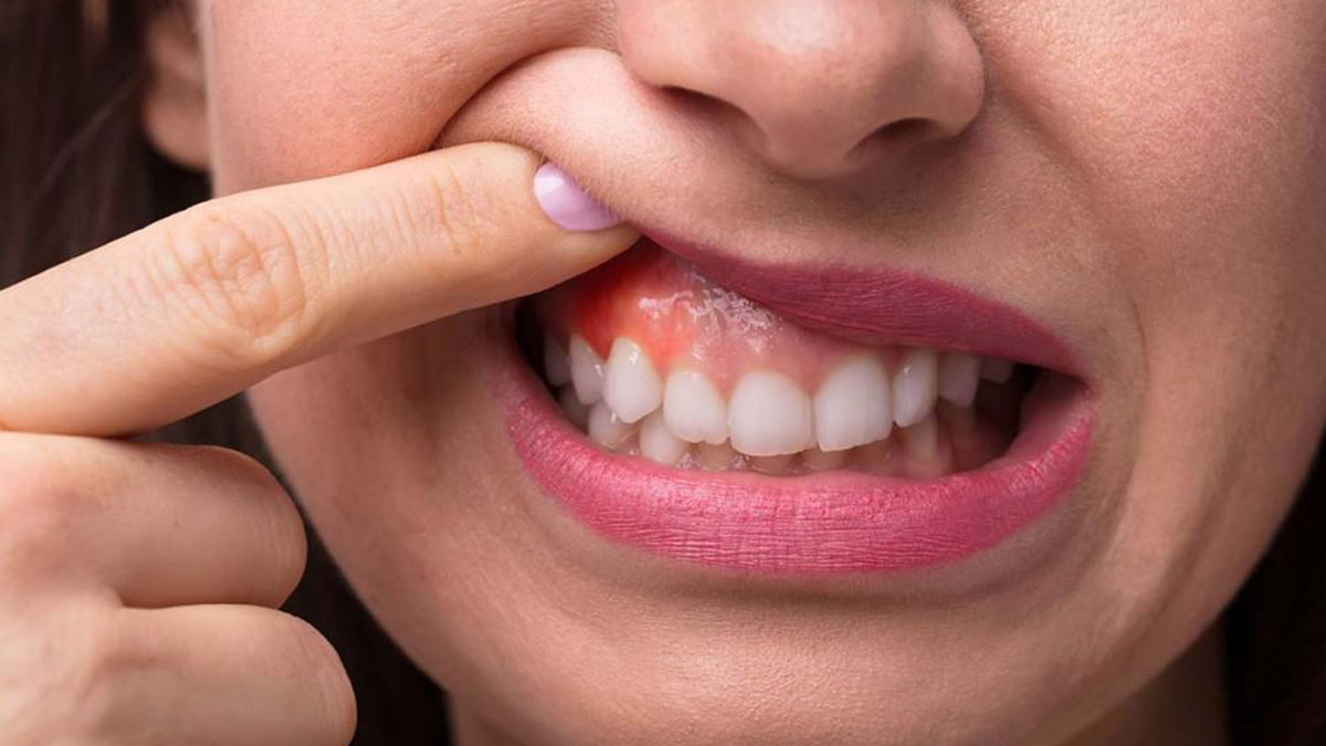 Diş fırçalarken bu hatayı sakın yapmayın! İltihaba neden olup dişlerinizi kaybedebilirsiniz, şakası yok