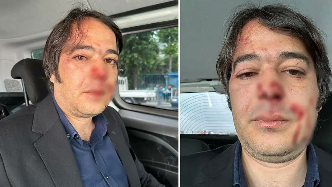 İBB yöneticisine saldırmışlardı: 1 milyon ver serbest kal!