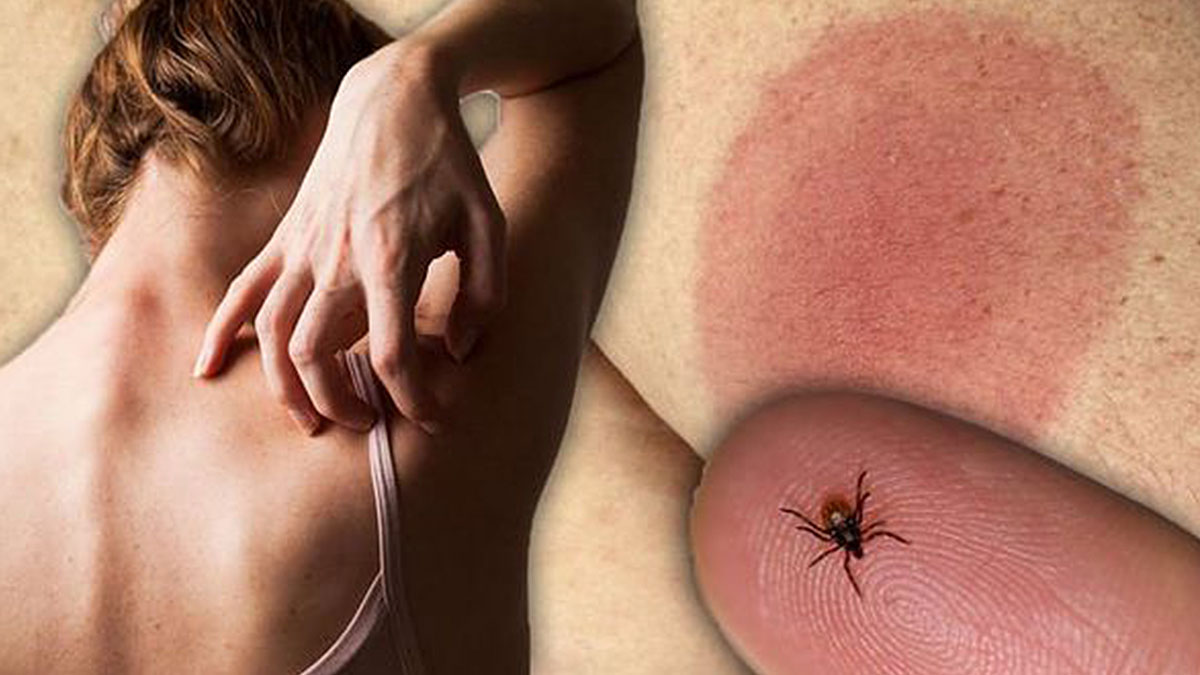 Isırdığı kişiler vejetaryen oluyor, kızarıklıktan uyuyamıyor! 18 Haziran'dan sonra her yeri istila edecek