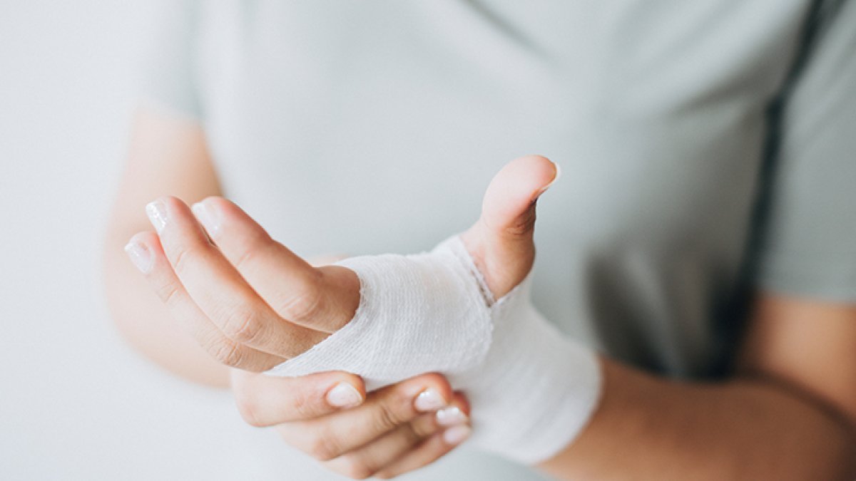 2. Derece Yanık: Belirtileri, Tedavisi ve İyileşme Süreci