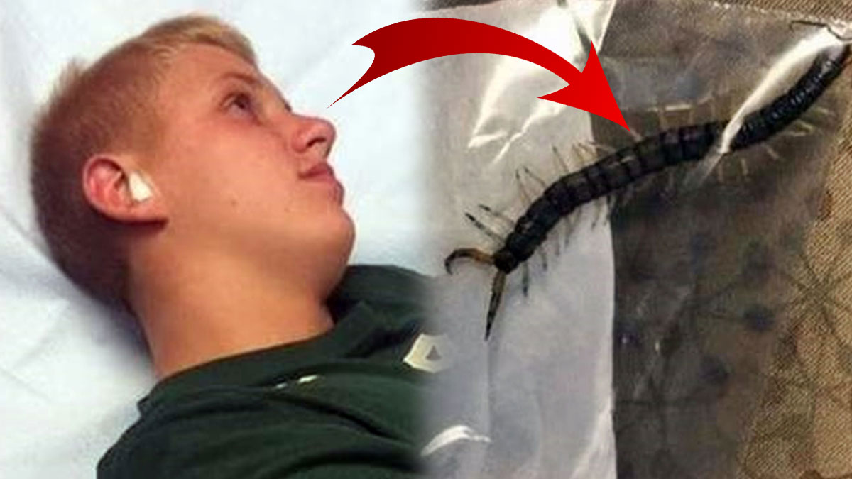 Uyurken hayatının şokunu yaşadı! Tam 10 santimetre boyunda, kuyruğundan çekip çıkardı