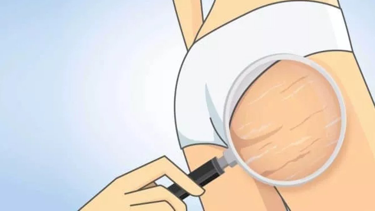 Çatlaklara Ne İyi Gelir: Doğal Çözümler ve Öneriler