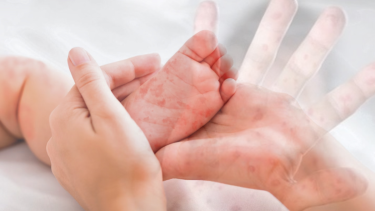 Kızamık tehdidi büyüyor: Vakaların sebebi 'aşısızlık'