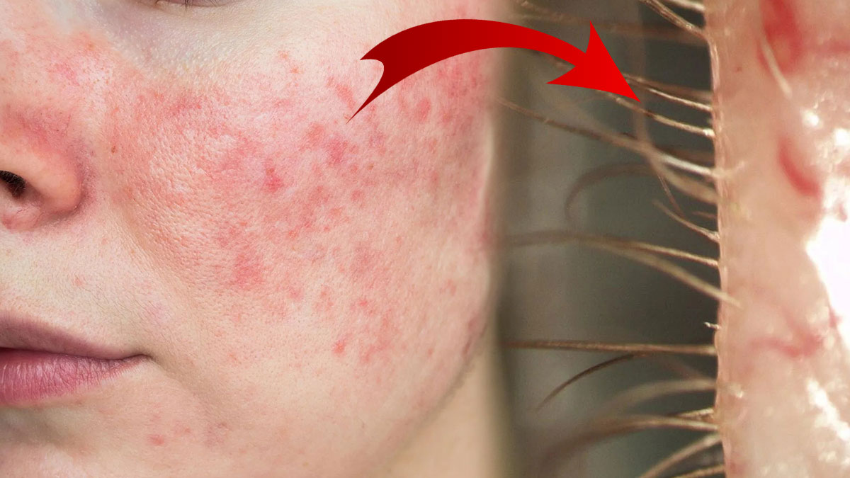 El sıkışıp öpüşürken bir daha düşünün! Yüz binlercesi yüzümüzde ve elimizde yaşıyor, temasla anında bulaşıyor