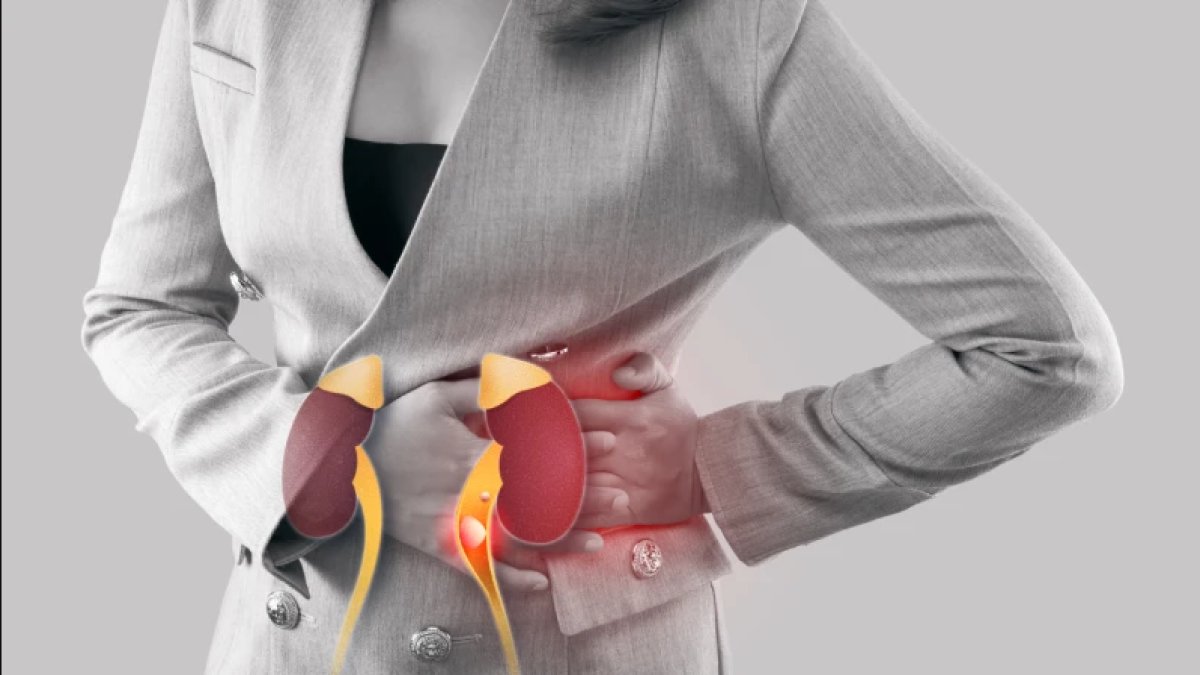 Böbrek Yetmezliği Belirtileri: Tanı, Nedenler ve Tedavi