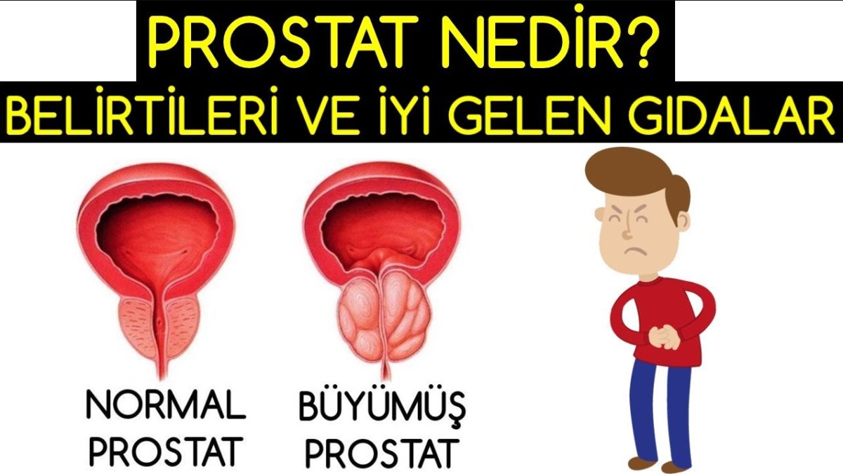 Prostat Belirtileri: Erkeklerde Sık Görülen Sağlık Sorununun İşaretleri ve Belirtileri