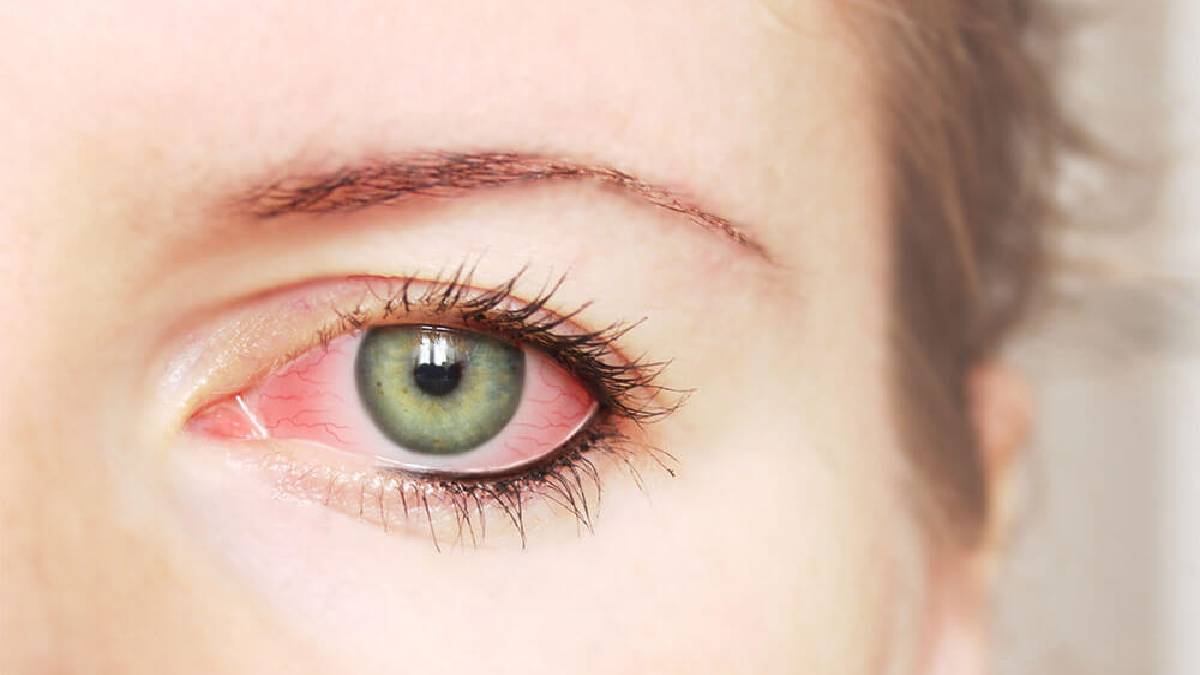 10.00-16:00 saatleri için uyarı yapıldı! Bu hata kör olma riskini 2 kat arttırıyor: Sakın dışarı çıkmayın