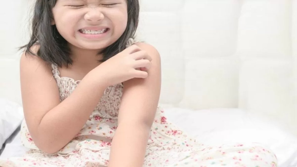 Uyuz Nasıl Geçer: Kaşıntılı Deri Rahatsızlığının Etkili Çözümleri