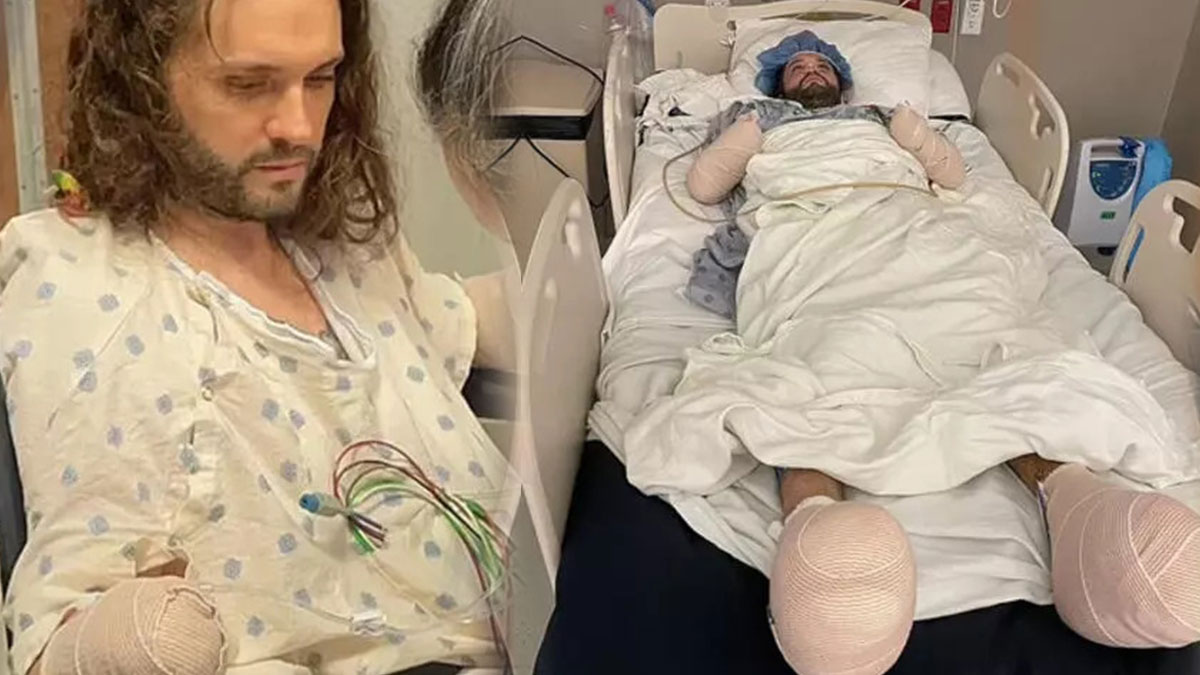 Bir böcek yüzünden el ve ayakları kesildi! Bu böcek türünü gördüğünüz yerde kaçın