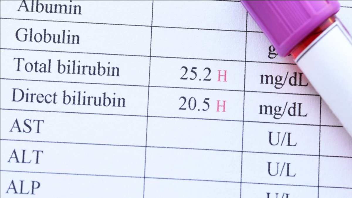 Bilirubin Nedir: Karaciğer Fonksiyonları ve Sağlığımızdaki Önemi