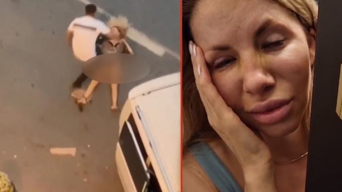 Esenyurt'ta darp edilen genç kadın ilk kez konuştu: Adam ruh hastası