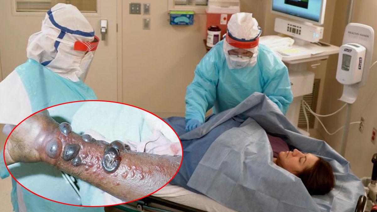 Bu virüs 8-9 günde öldürüyor: Yeni salgın paniği! Bu belirtiler varsa dikkat