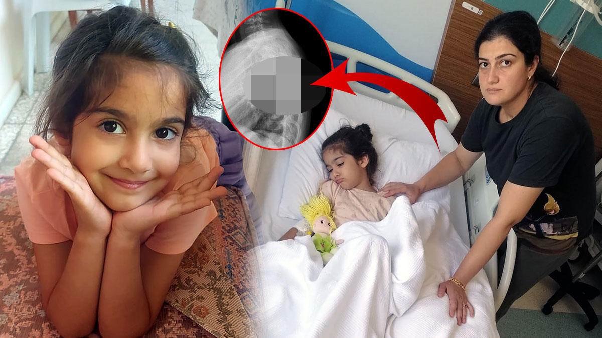 Kanlar içinde eve gelen kızının sırtına demir battı sandı, hastaneye gidince hayatının şokunu yaşadı!