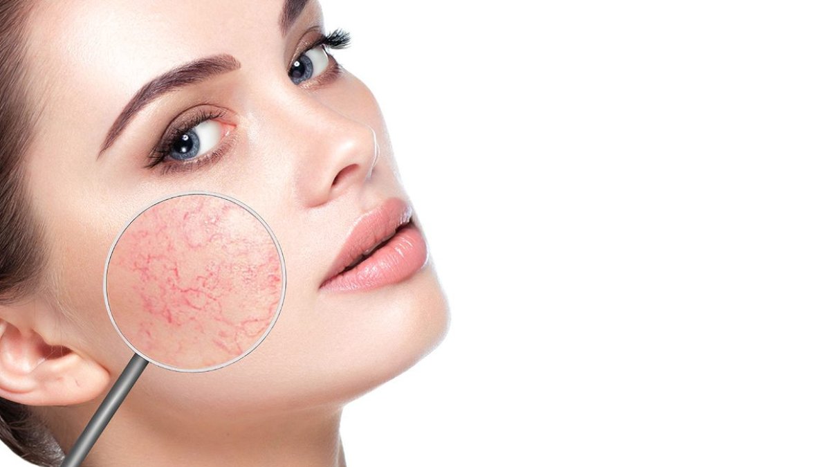 Dermatoloji Nedir: Cilt Sağlığının Uzmanıyla Tanışın