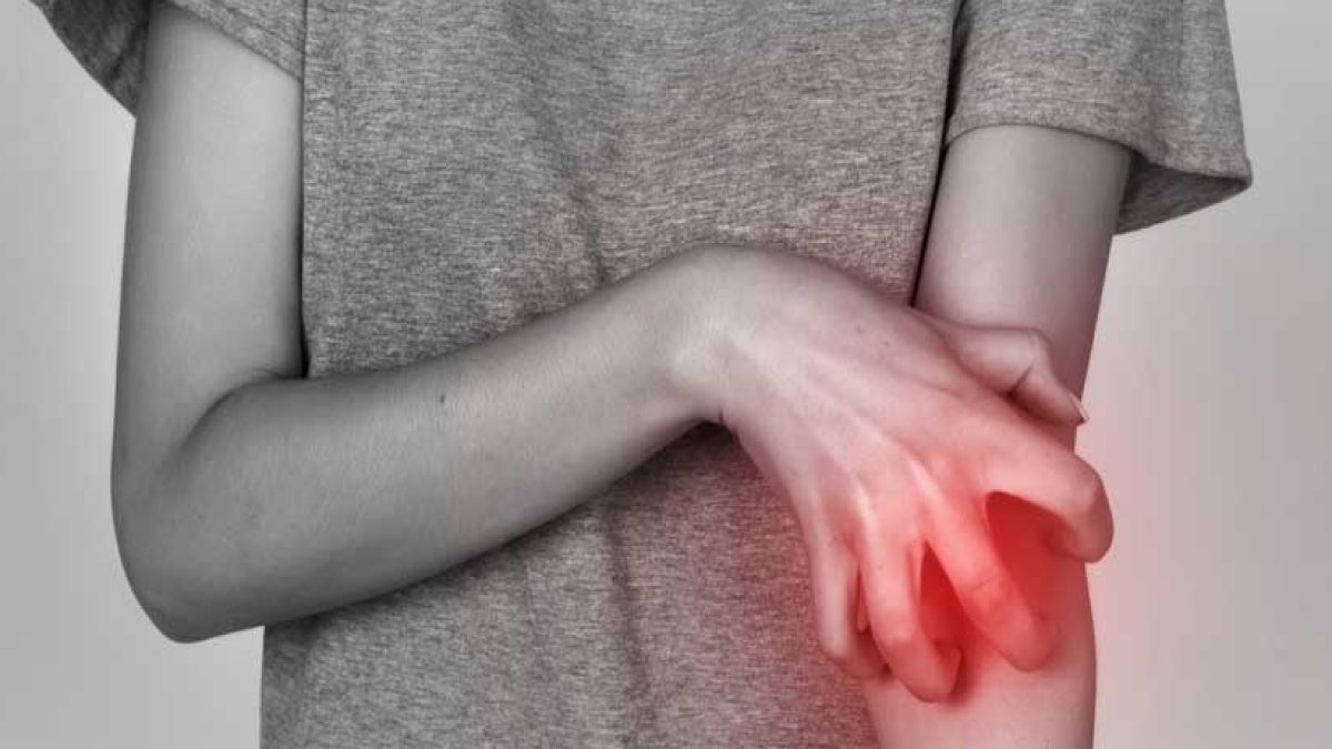 Uyuz Nasıl Bulaşır: Uyuz Hakkında Bilmeniz Gerekenler