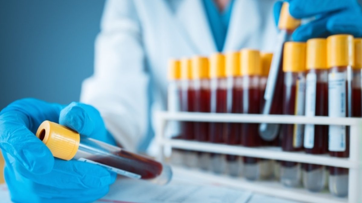 T.C. Kimlik Numarası ile Tahlil Sonucu Öğrenme