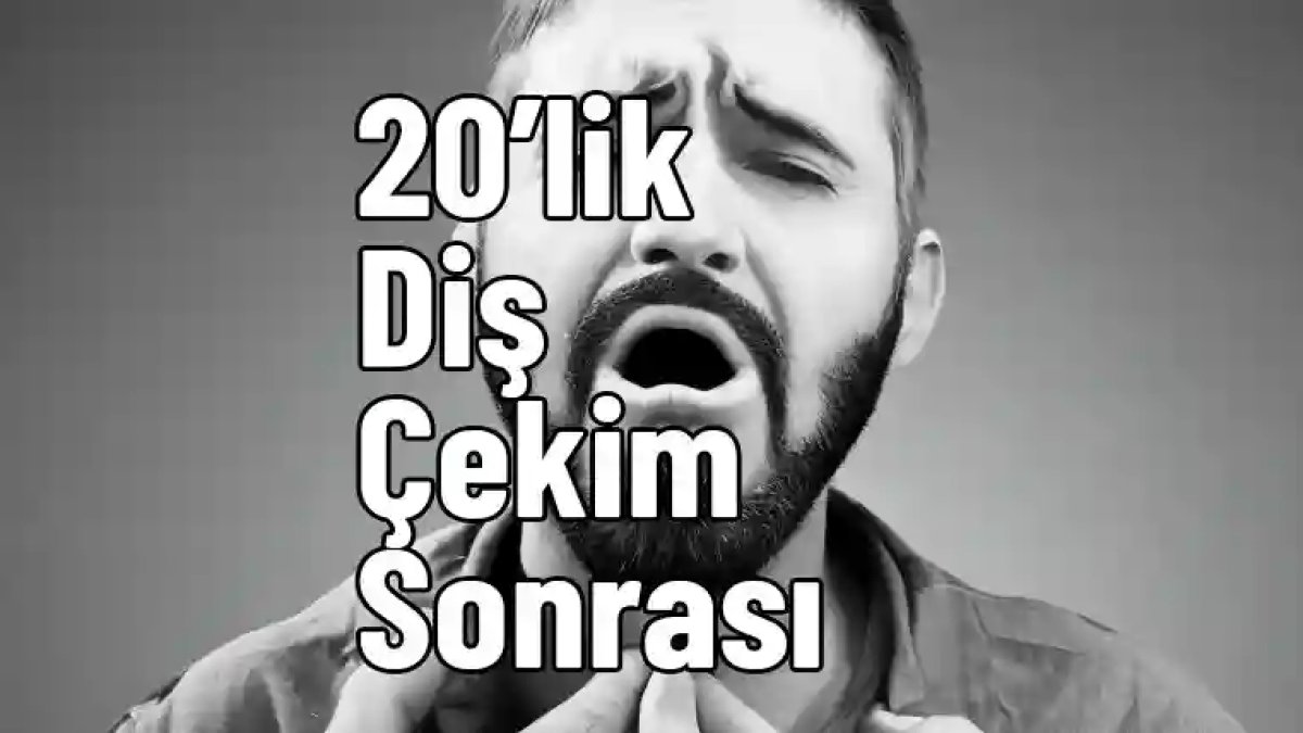 20'lik Diş Çekimi Sonrası Ağrı Nasıl Geçer?