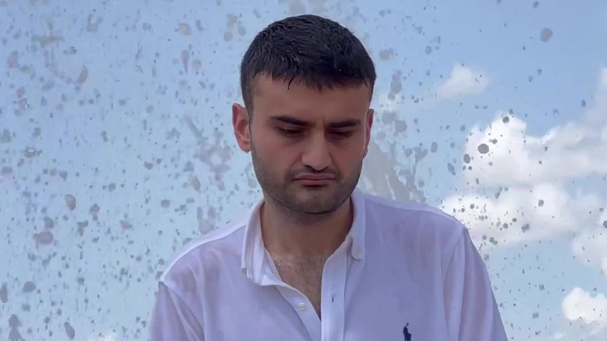 CZN Burak, son haliyle sevenlerini korkuttu! Zor günler geçiriyordu, üzüntüden iğne ipliğe döndü