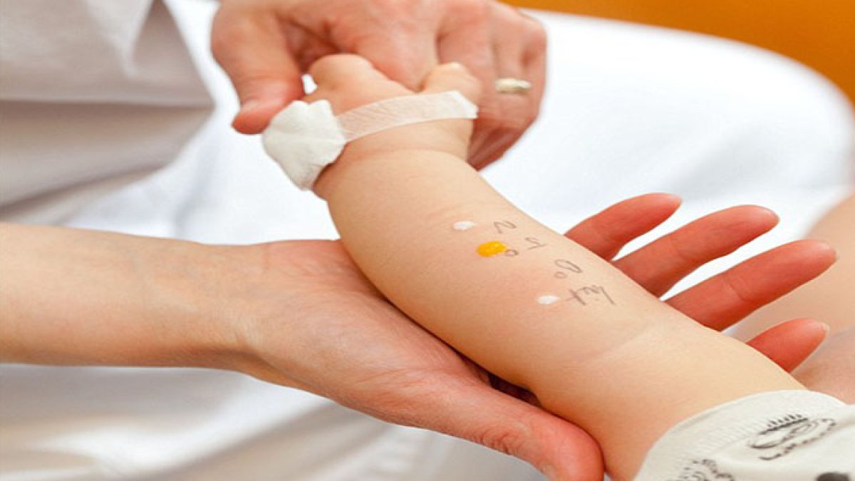 Kanda Alerji Testi Sonuçları Nasıl Yorumlanır?