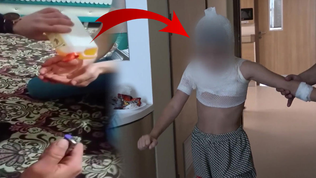 Sosyal medyada gördüğünü evde yapmak isterken felaketi yaşadı! Uzmanlardan ailelere uyarı