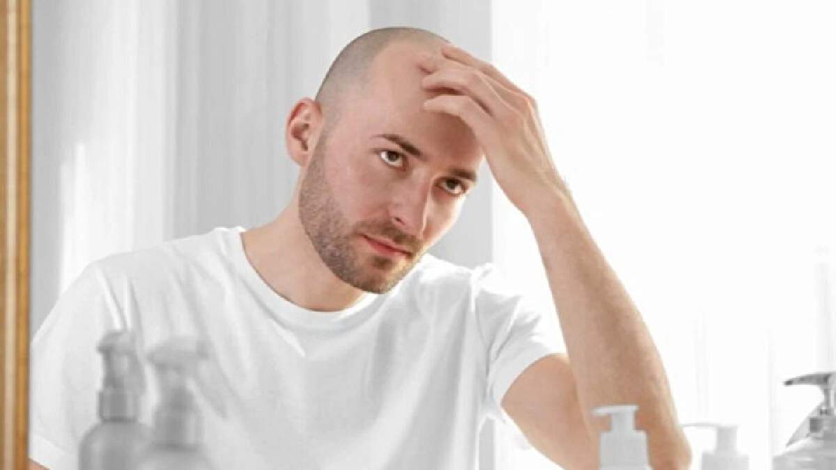 İşte kellerin kendini en mutlu hissettiği ülke! Ülkelerin saç haritası çıkarıldı: Birinci sıradaki ülke şaşırttı