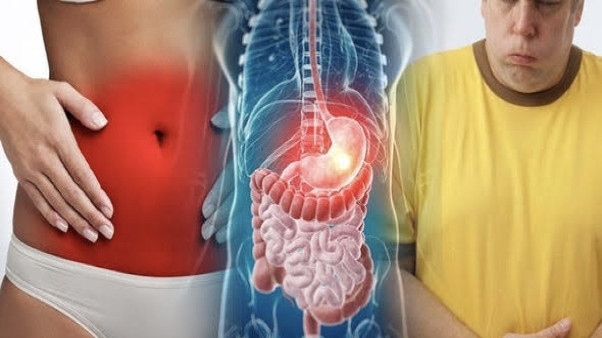 Gastrit, ülser, mide ekşimesini şak diye bitiriyor! Türk kahvesine 1 damla ekleyin, gerisine karışmayın… hem doğal hem basit