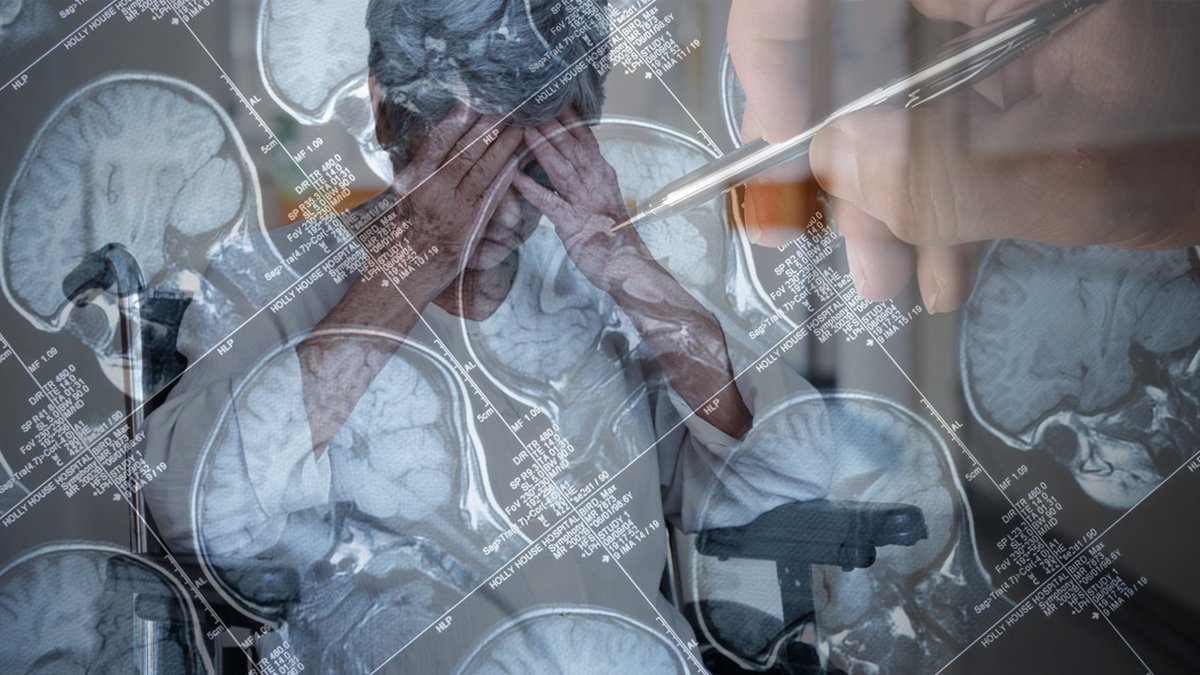 Alzheimer'a karşı bakır kalkanı: Fare deneylerinde zehirli proteinler yüzde 42 azaldı