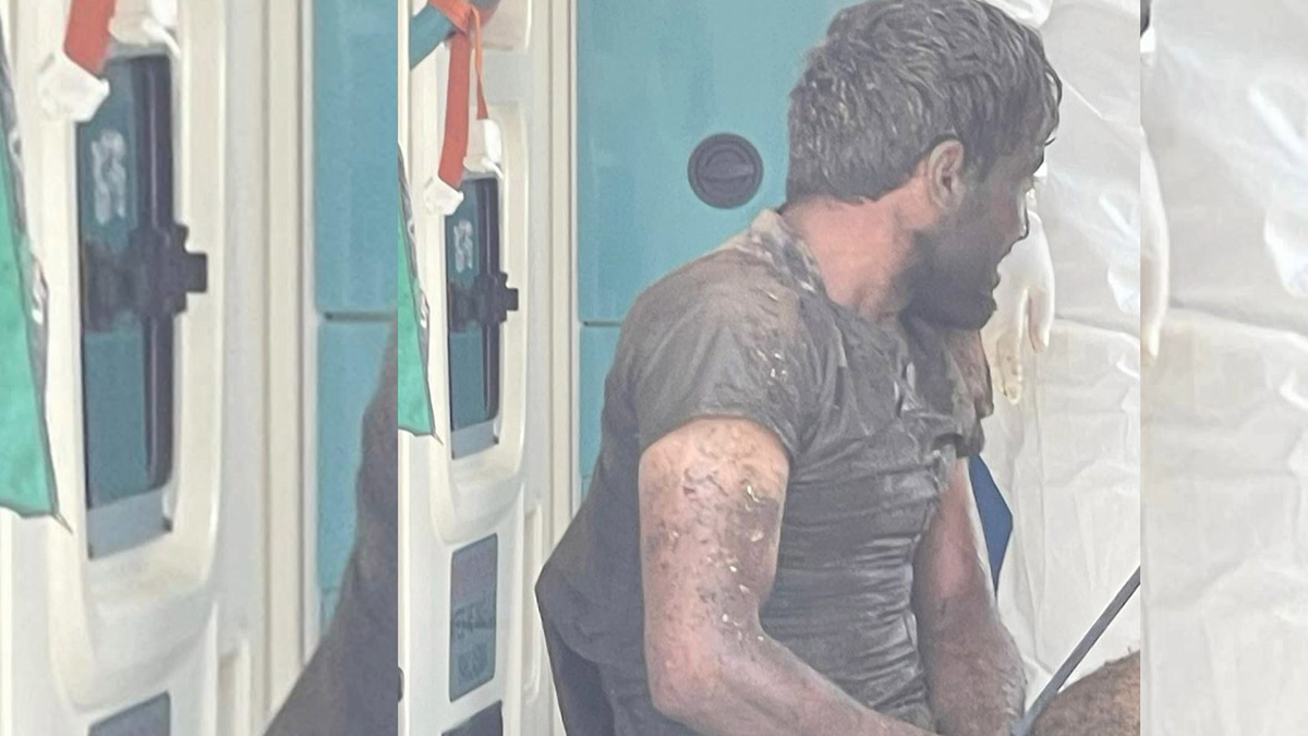 Şanlıurfa'da panik! Kuduz hastası hastaneden kaçtı