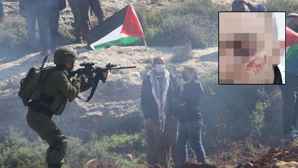 İsrail polisi şiddette sınır tanımıyor: Filistinli gencin yüzüne Davud Yıldızı kazıdılar