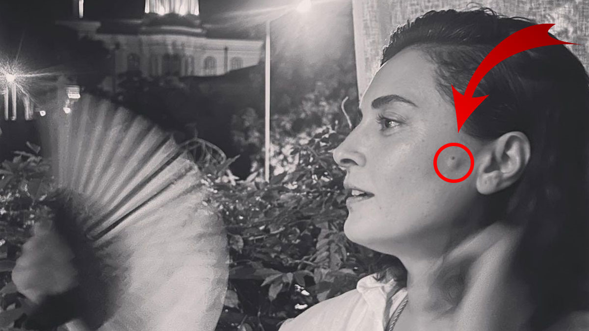 Yanağındaki şişlik korkuttu: Hastalık belirtisi mi? Hep gizliyordu, son paylaşımında ortaya çıktı