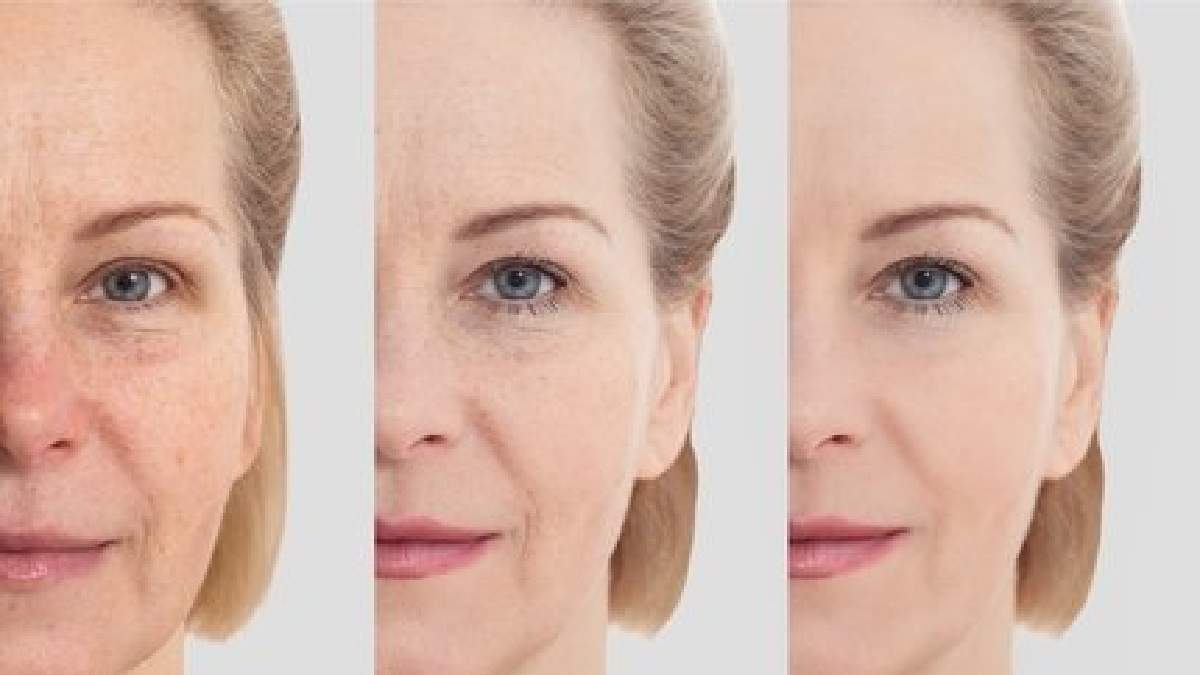 20'li yaşlara döndüren kolajen maskesi tarifi! Pahalı markalara para harcamaya son: 2 haftada kesin etki