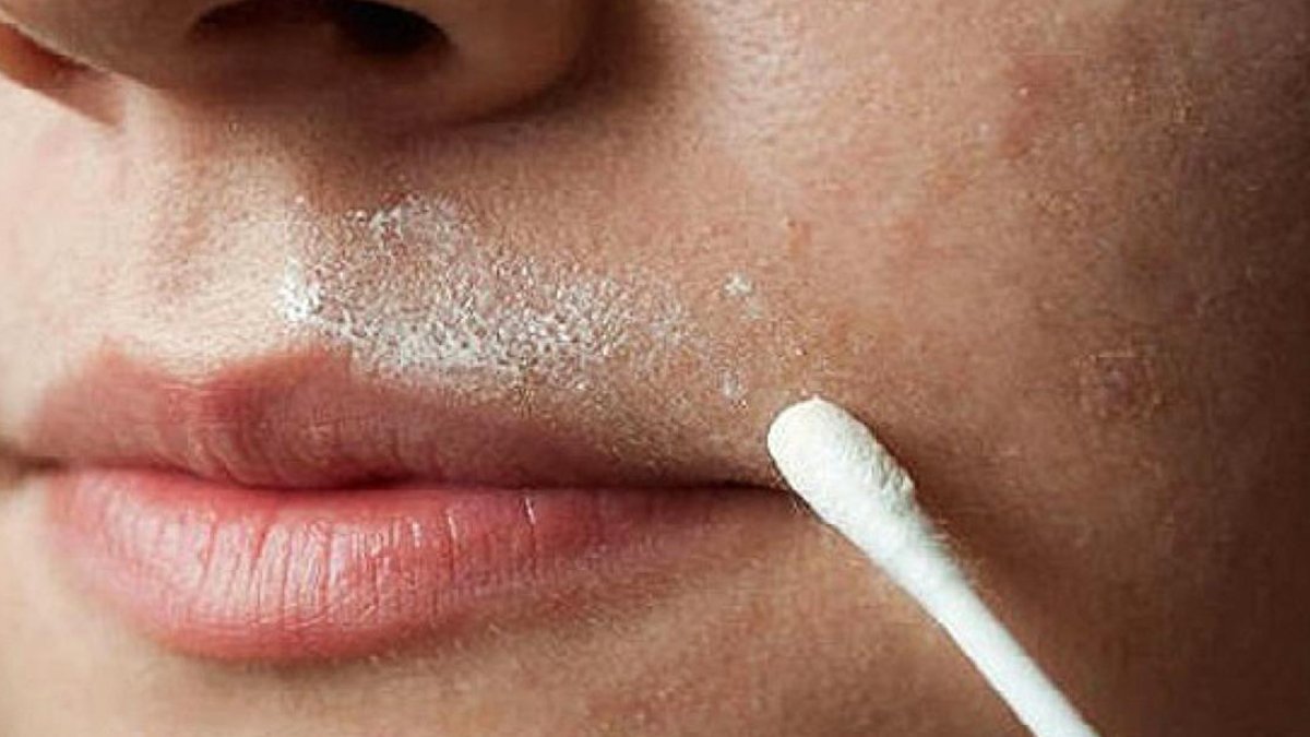 Yüzünüzdeki tüyleri anında yok ediyor! Bu mucizevi yöntem tüylerin kökünü kazıyor