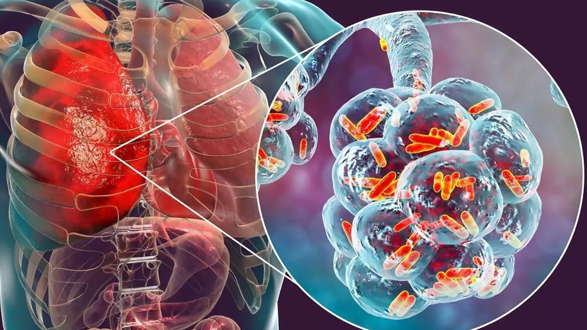 Yeni bir salgın mı başlıyor? 'Lejyoner' beş can aldı