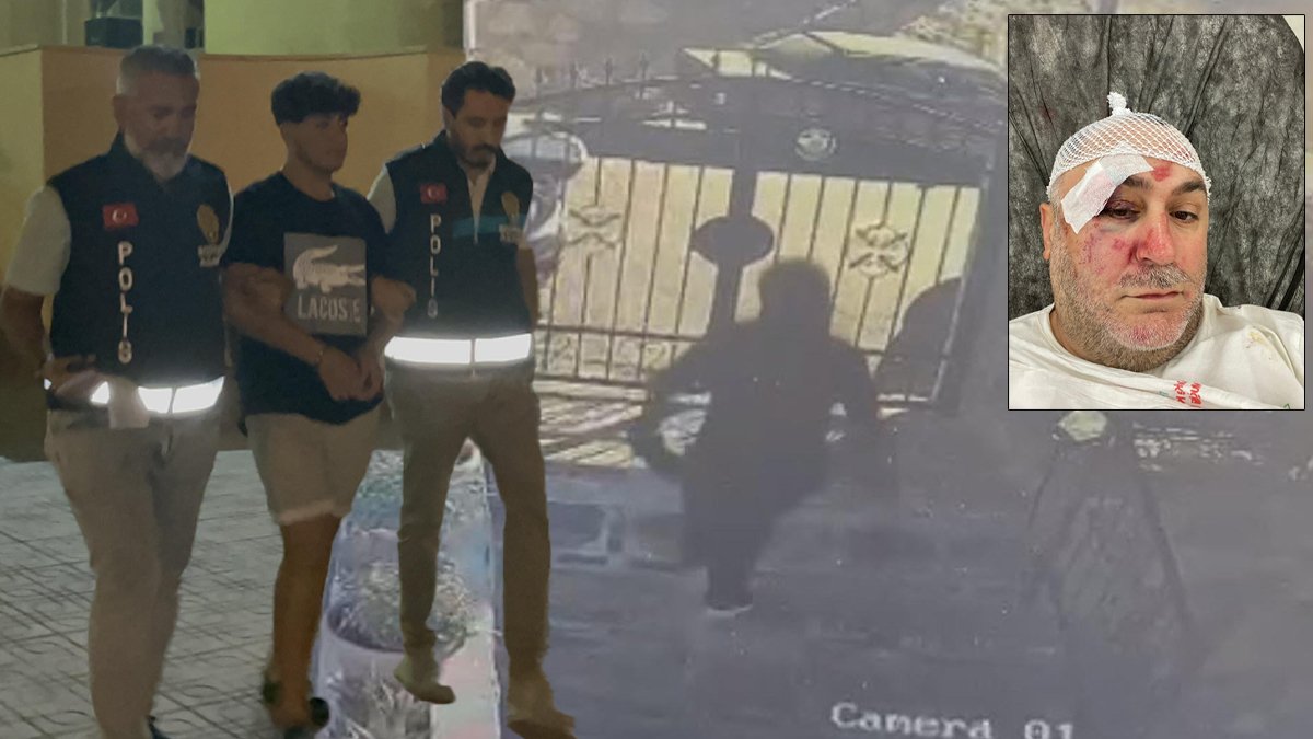 Çalışanlarından restoran sahibine 'dambıl'lı saldırı: Gasbedip çalışmaya devam ettiler