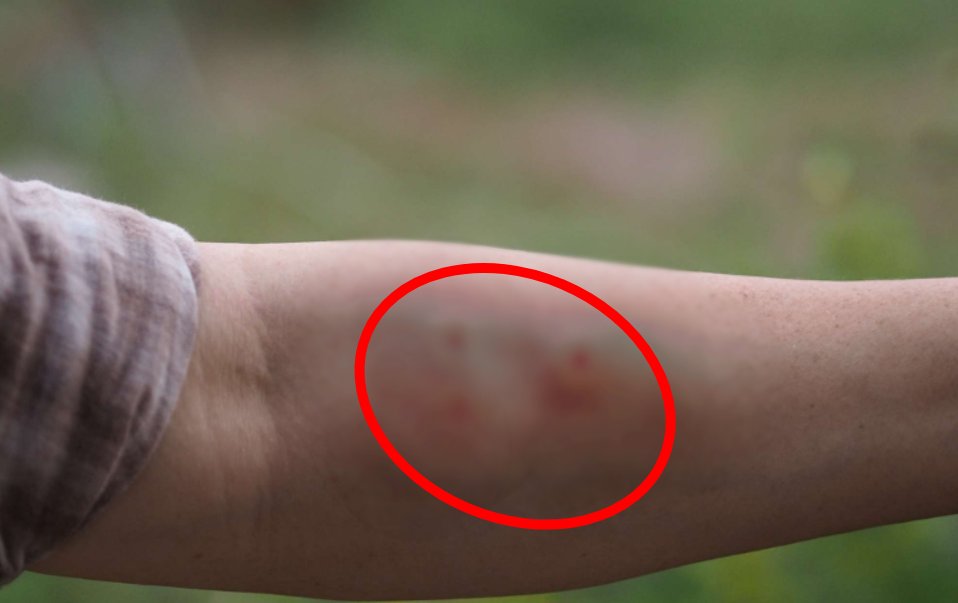 Tek ısırığı komaya sokuyor! Sürü sürü saldırıya geçtiler! Hastaneler doldu taştı! Çok nadir...