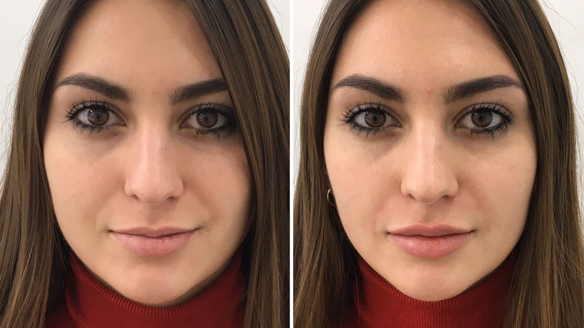 Bu doğal yöntemle dolgun dudaklara sahip olun! Kimyasal ya da enjeksiyona gerek yok, mucize karışımı sürmek yeterli