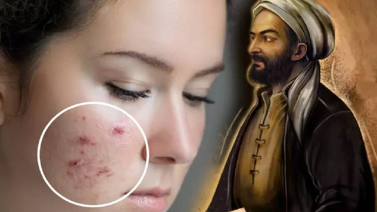 Asırlar önce İbn-i Sina önerdi! Bu meyve cilt hastalıklarını yok ediyor… Yıllardır boşa uğraşmışız